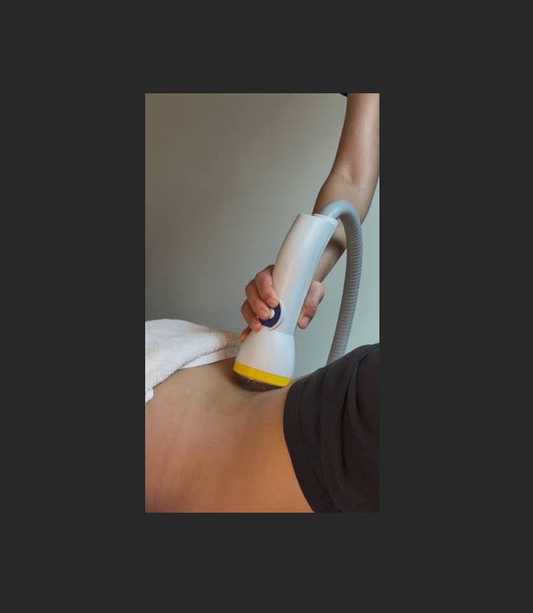 Softwave alleviates 30 years of back pain